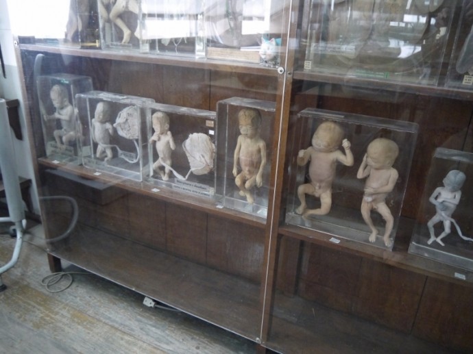Displays At Anatomical Museum, Bangkok Displays At Anatomical Museum, Bangkok