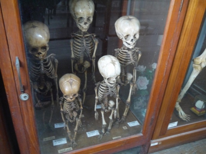 Child Skeletons