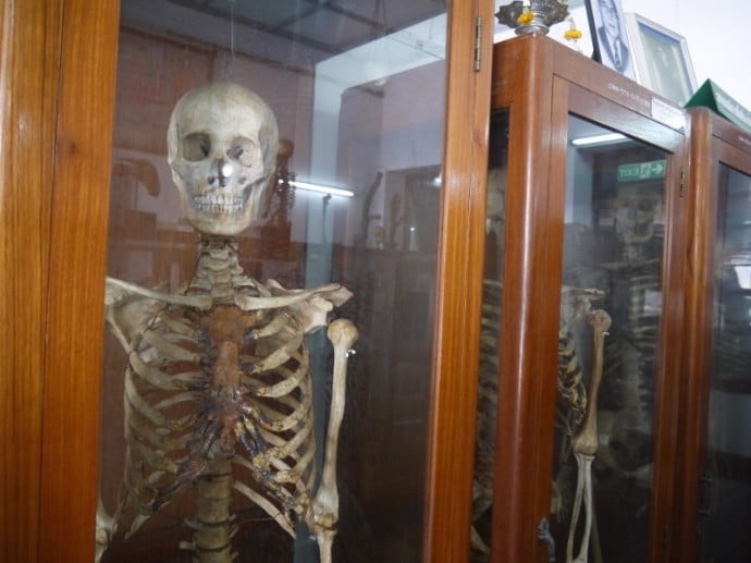 Skeletons On Display