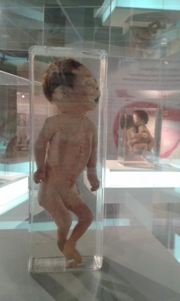 Forensic Medicine Museum Displays Forensic Medicine Museum Displays