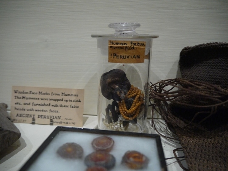 Peruvian Fetus Wearing An Earring At Pitt Rivers Museum, Oxford